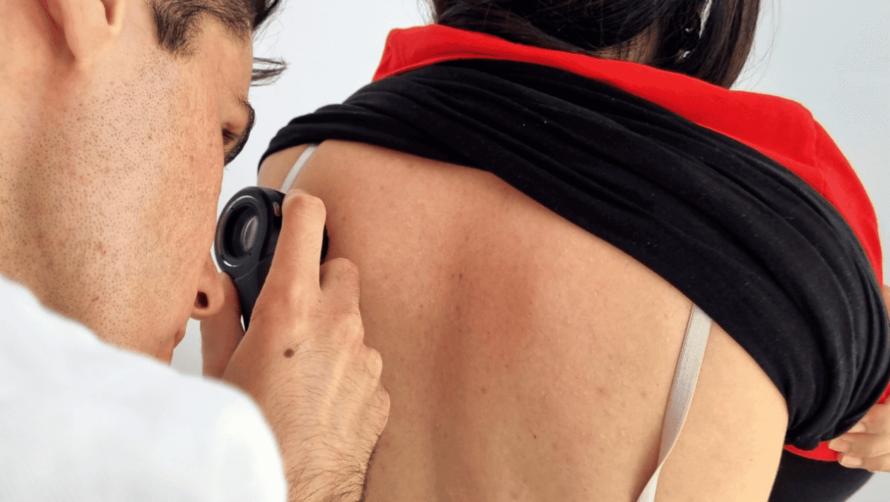 Građani na besplatnim dermatološkim pregledima u Zadru u sklopu kampanje „Zaštiti se... i uživaj na suncu“