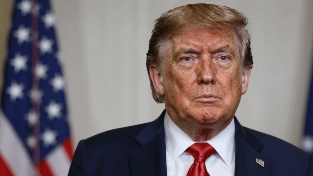 Trump optužen za izbijanje ciklosporijaze diljem SAD-a