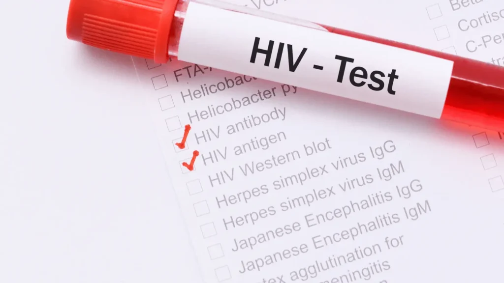 Tumorski okoliš i HIV rezervoari Novi put do izlječenja