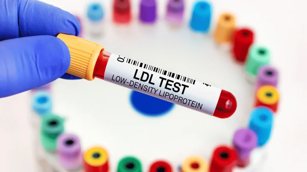 Analiza krvi za određivanje vrijednosti lipoproteina(a) i procjenu kardiovaskularnog rizika
