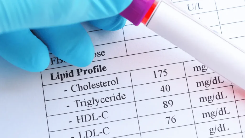 Analiza krvi za određivanje vrijednosti lipoproteina(a) i procjenu kardiovaskularnog rizika
